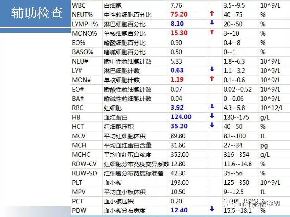 影像PPT - 【病例】结核千千面-4 影像PPT - 【病例】结核千千面-4