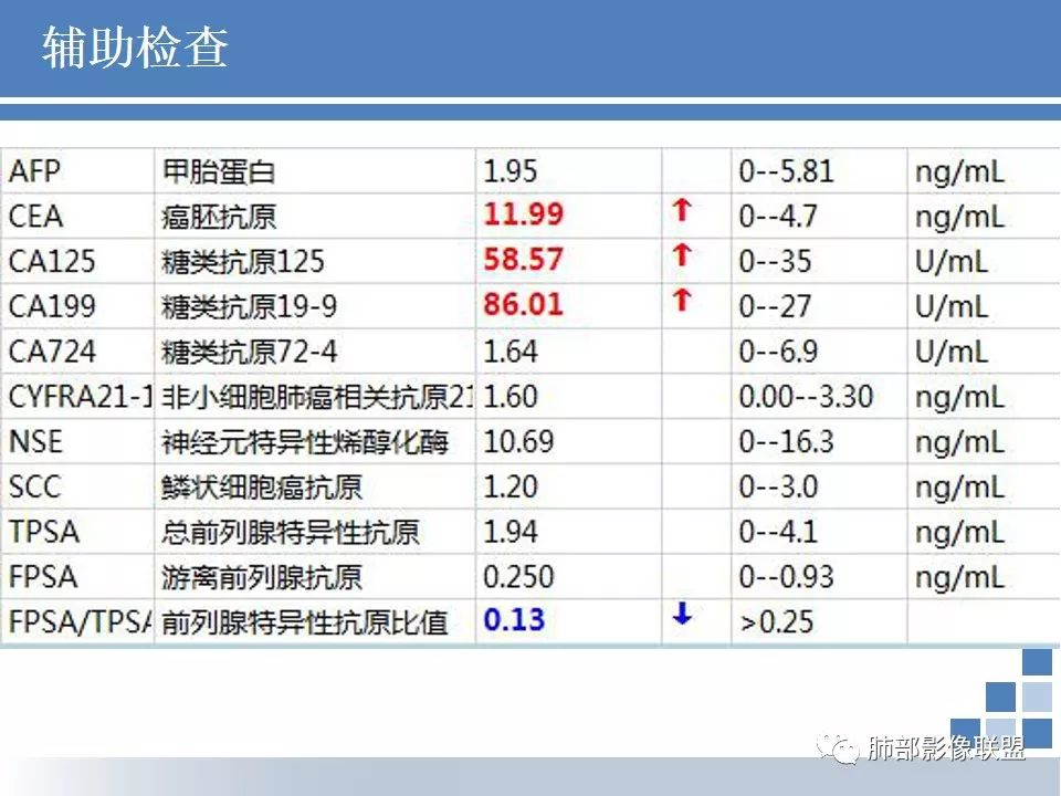 影像PPT - 【病例】结核千千面-5 影像PPT - 【病例】结核千千面-5