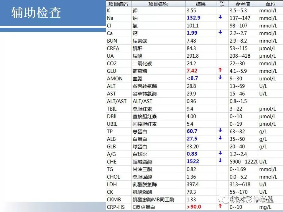 影像PPT - 【病例】结核千千面-9 影像PPT - 【病例】结核千千面-9