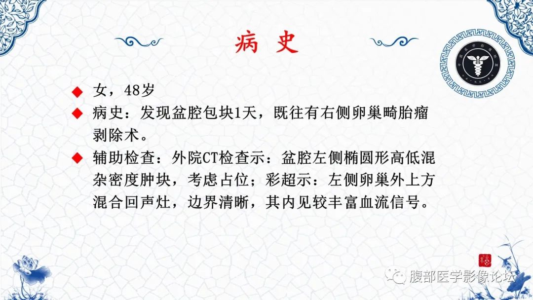 影像PPT - 【病例】腹膜后炎性肌纤维母细胞瘤1例CT及MR诊断及鉴别-2
