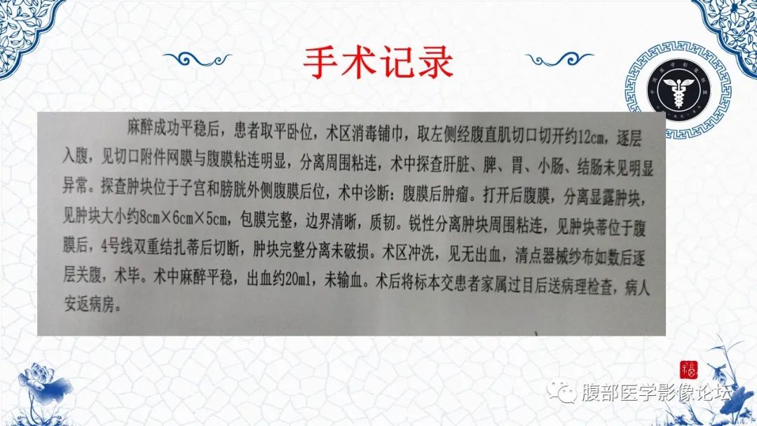 影像PPT - 【病例】腹膜后炎性肌纤维母细胞瘤1例CT及MR诊断及鉴别-17