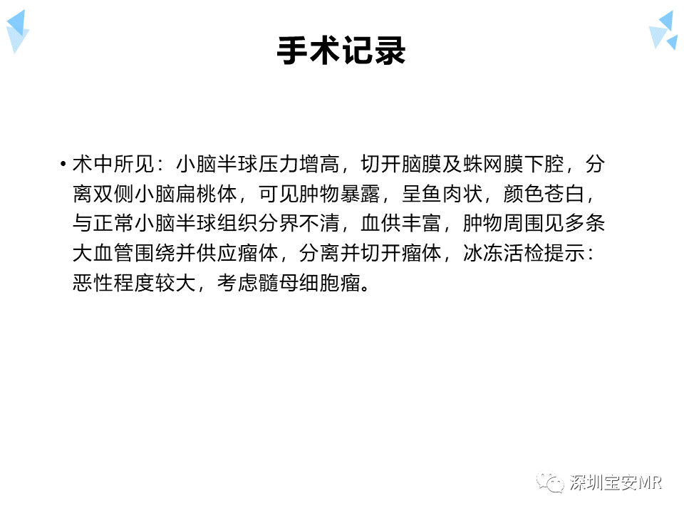 影像PPT - 【病例】成人型髓母细胞瘤2例CT及MR影像-18