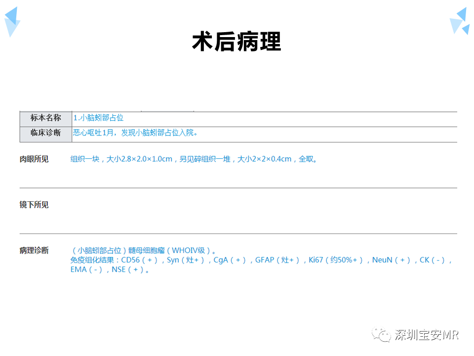影像PPT - 【病例】成人型髓母细胞瘤2例CT及MR影像-19