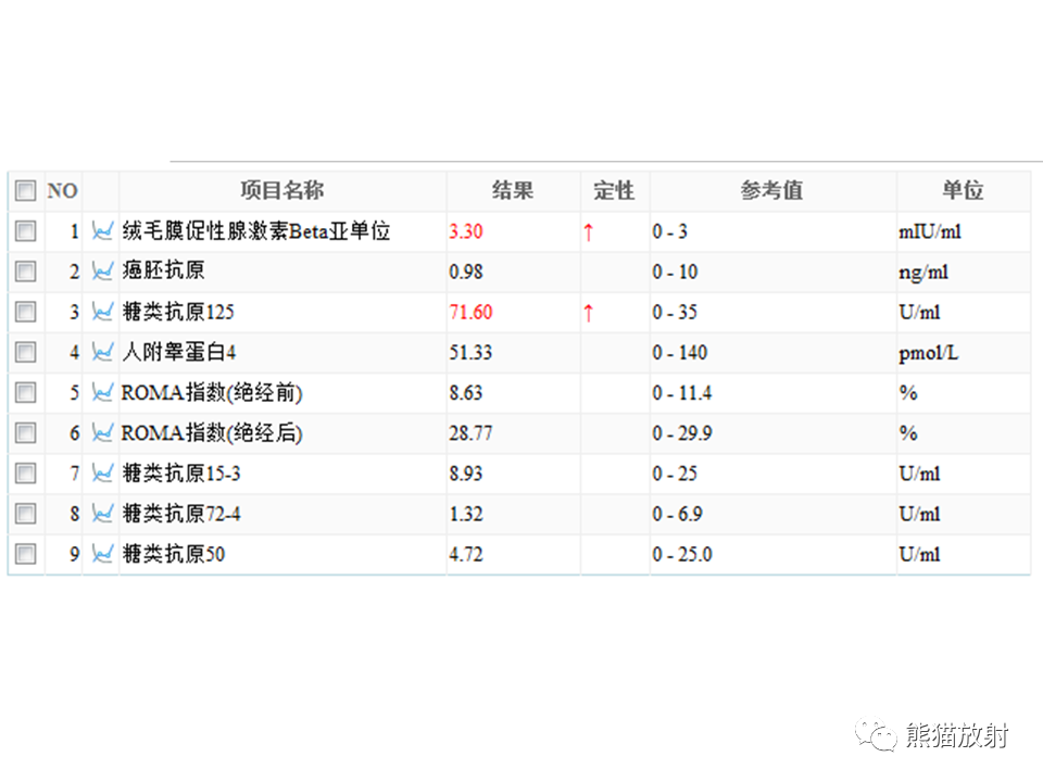 影像PPT - 【病例】卵巢卵泡膜纤维瘤2例MR影像-3