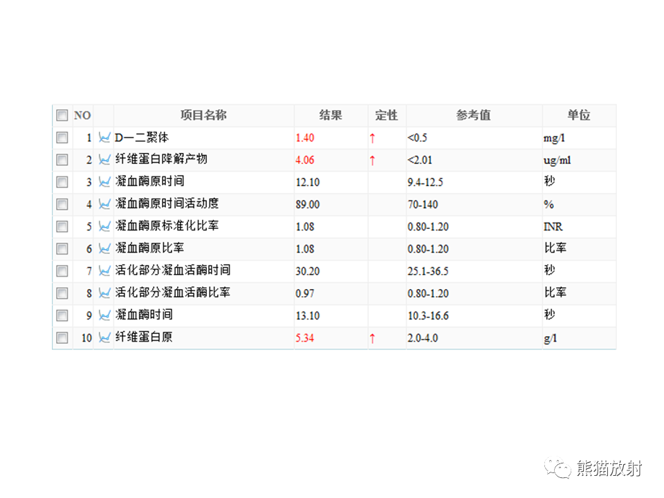 影像PPT - 【病例】卵巢卵泡膜纤维瘤2例MR影像-17