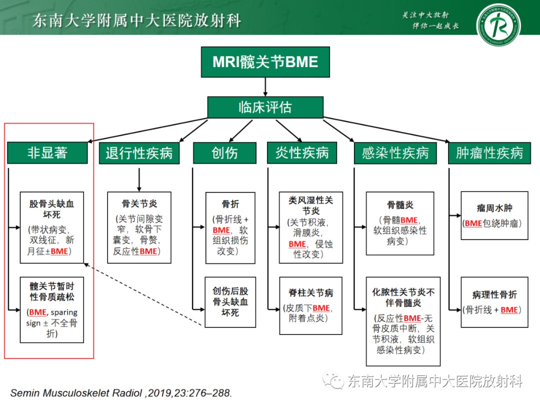 影像PPT - 【PPT】髋关节暂时性骨质疏松症TOH-7