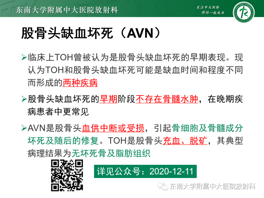 影像PPT - 【PPT】髋关节暂时性骨质疏松症TOH-20