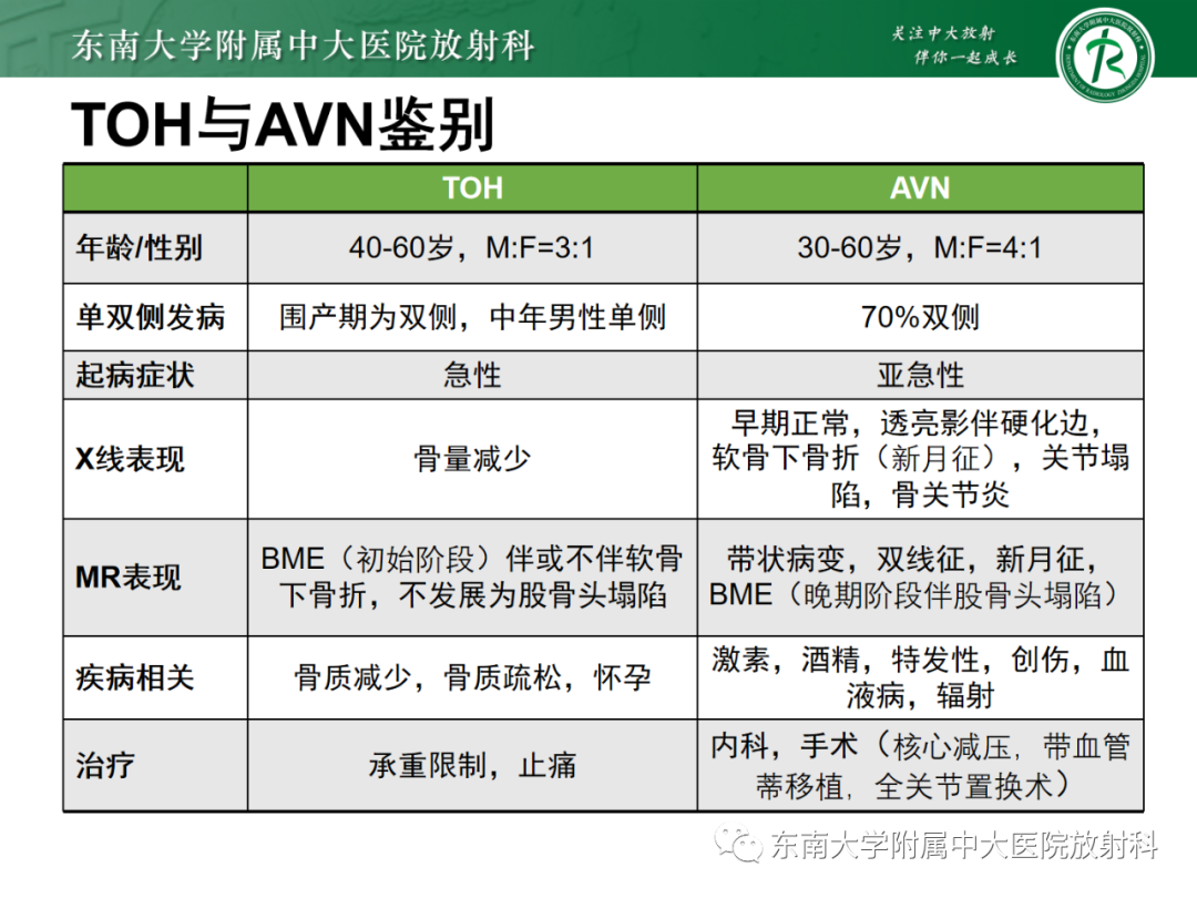 影像PPT - 【PPT】髋关节暂时性骨质疏松症TOH-21