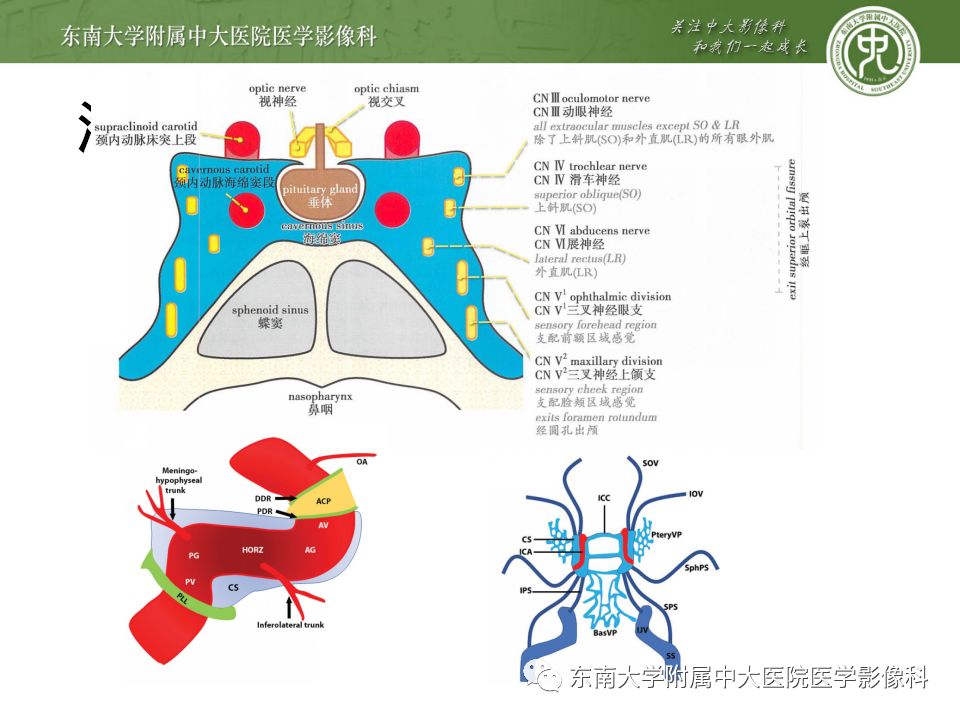 影像PPT - 【PPT】海绵窦区常见肿瘤性病变的影像-11