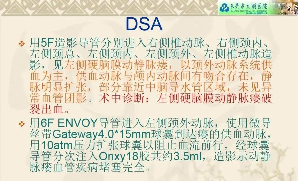 影像PPT - 【病例】硬脑膜动静脉瘘1例CT及DSA影像学表现-11