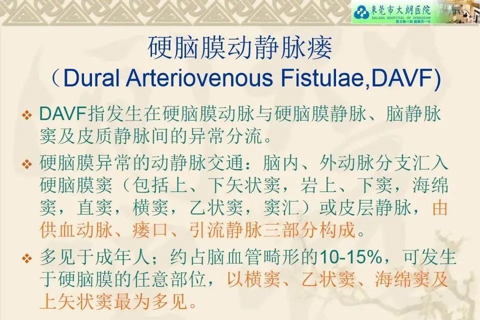 影像PPT - 【病例】硬脑膜动静脉瘘1例CT及DSA影像学表现-12