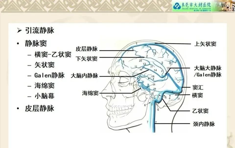 影像PPT - 【病例】硬脑膜动静脉瘘1例CT及DSA影像学表现-16