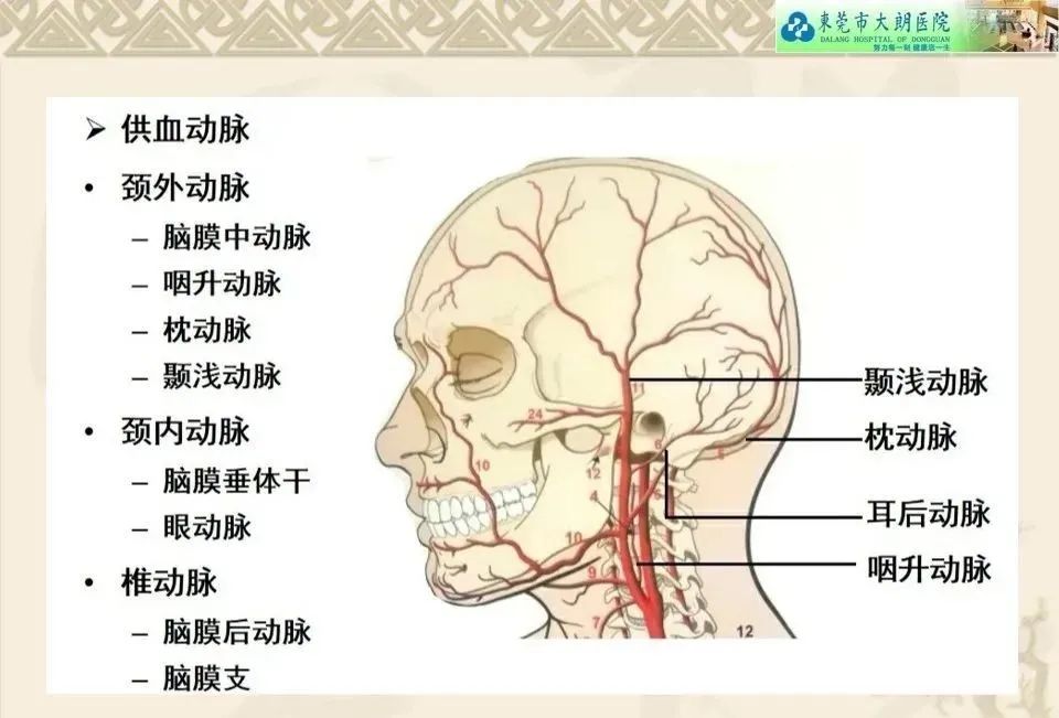 影像PPT - 【病例】硬脑膜动静脉瘘1例CT及DSA影像学表现-15