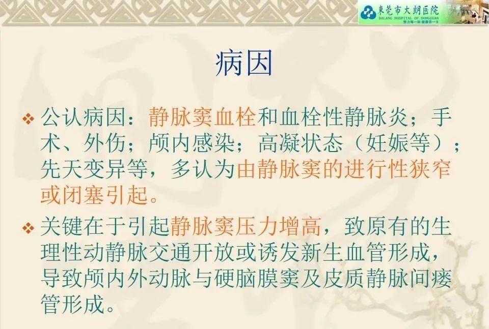 影像PPT - 【病例】硬脑膜动静脉瘘1例CT及DSA影像学表现-17