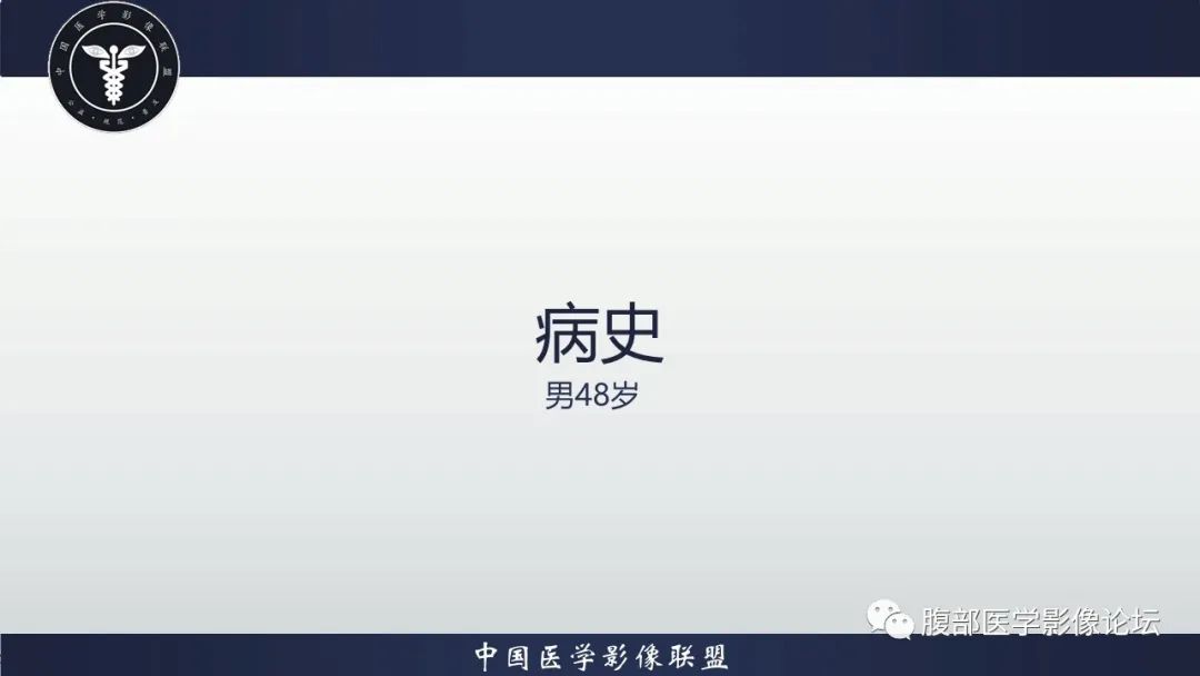 影像PPT - 【病例】腹膜后神经鞘瘤1例CT影像-2