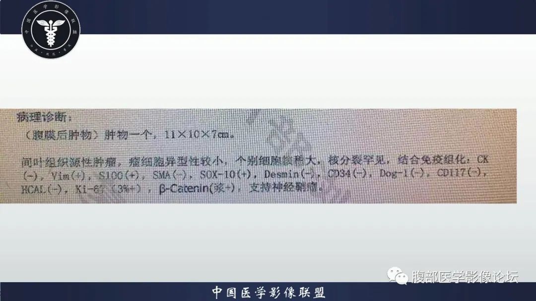 影像PPT - 【病例】腹膜后神经鞘瘤1例CT影像-10