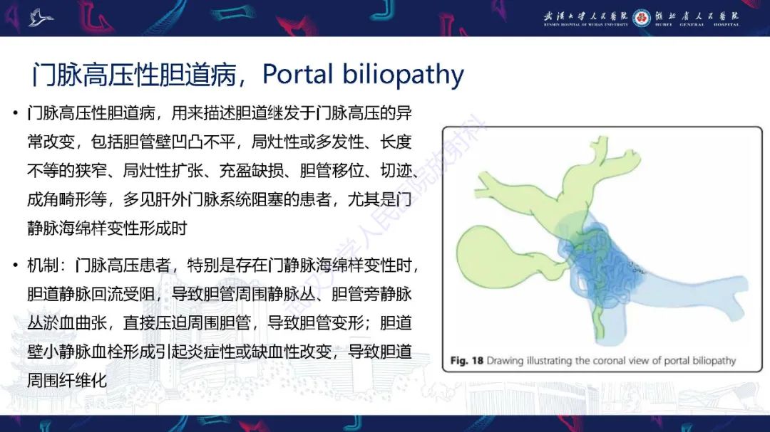 影像PPT - 【PPT】腹盆腔血管压迫综合征CT诊断-28