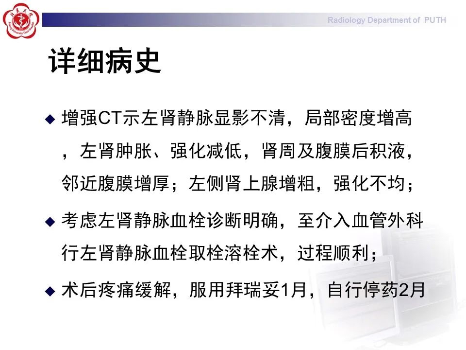 影像PPT - 【PPT】抗磷脂综合征合并双侧肾上腺坏死-6