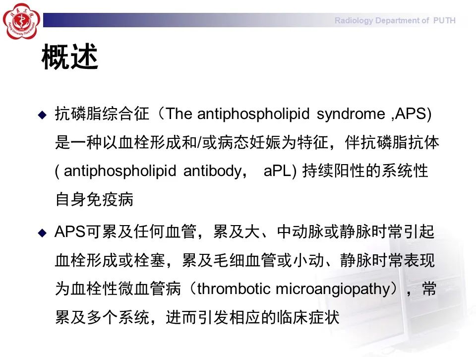 影像PPT - 【PPT】抗磷脂综合征合并双侧肾上腺坏死-16
