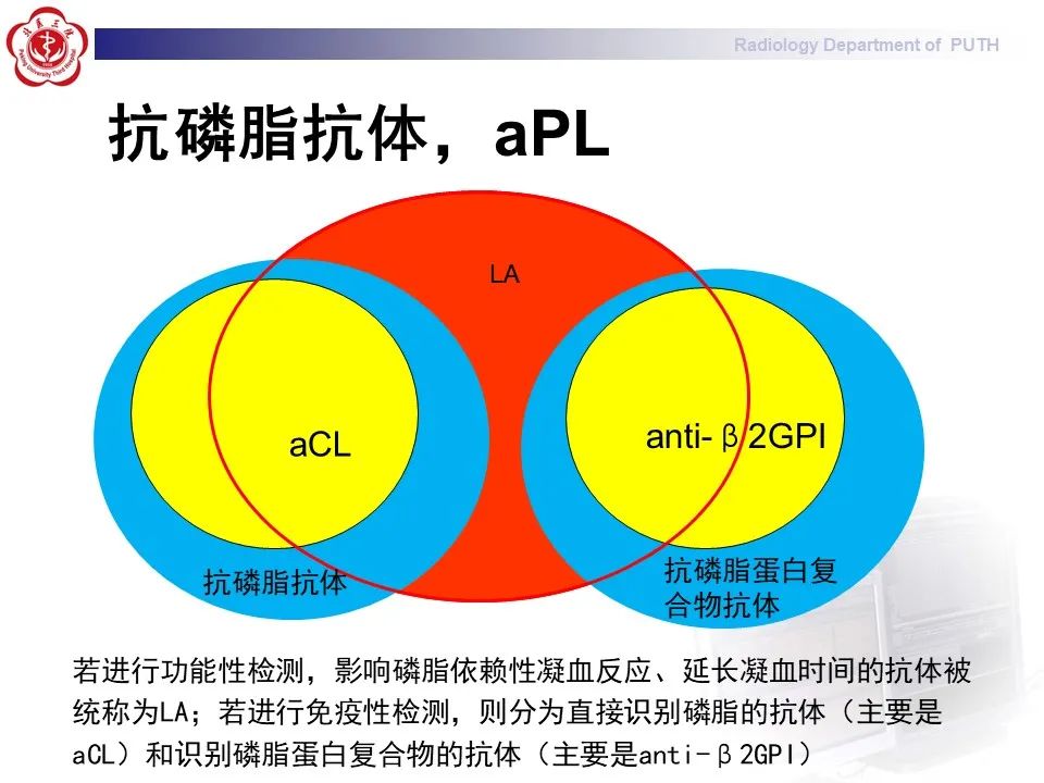 影像PPT - 【PPT】抗磷脂综合征合并双侧肾上腺坏死-18