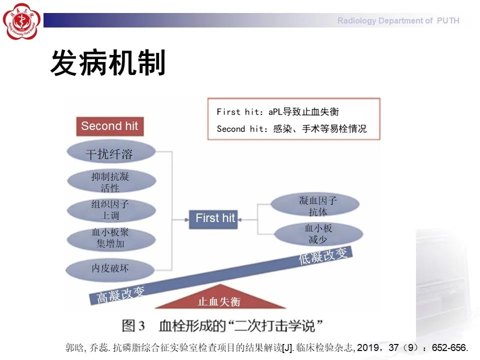 影像PPT - 【PPT】抗磷脂综合征合并双侧肾上腺坏死-20