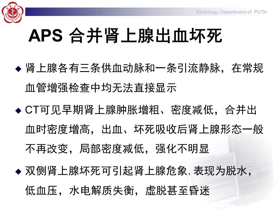 影像PPT - 【PPT】抗磷脂综合征合并双侧肾上腺坏死-25