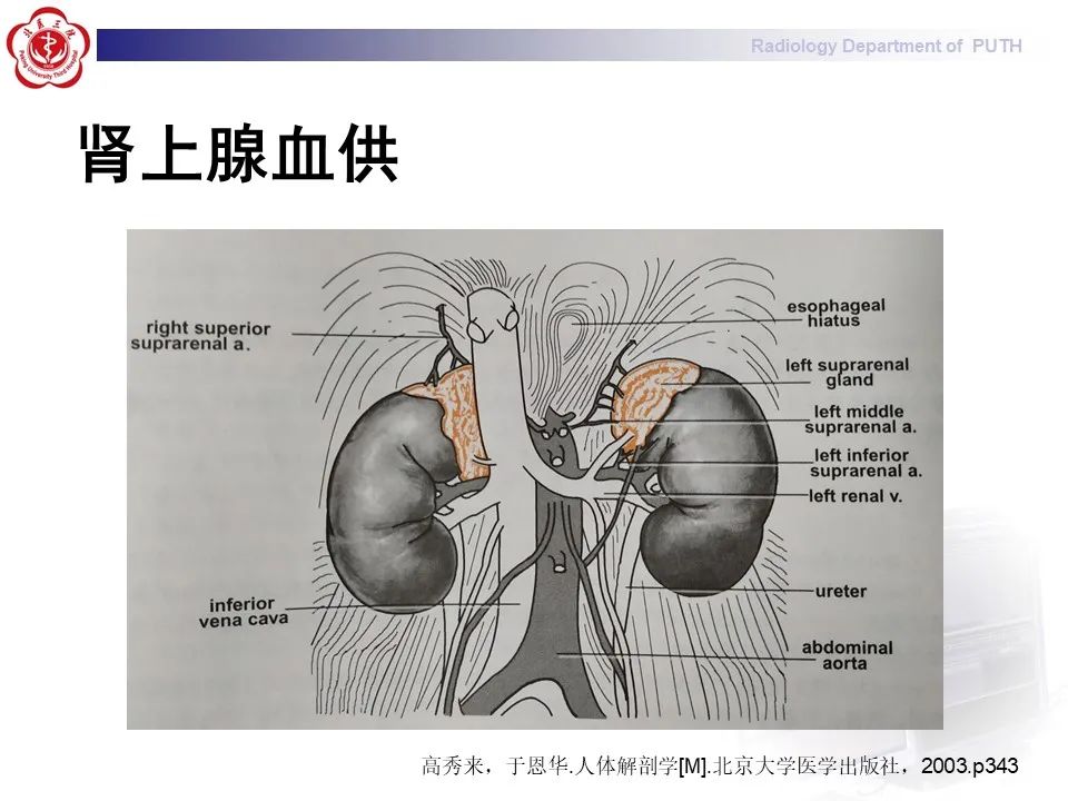 影像PPT - 【PPT】抗磷脂综合征合并双侧肾上腺坏死-26