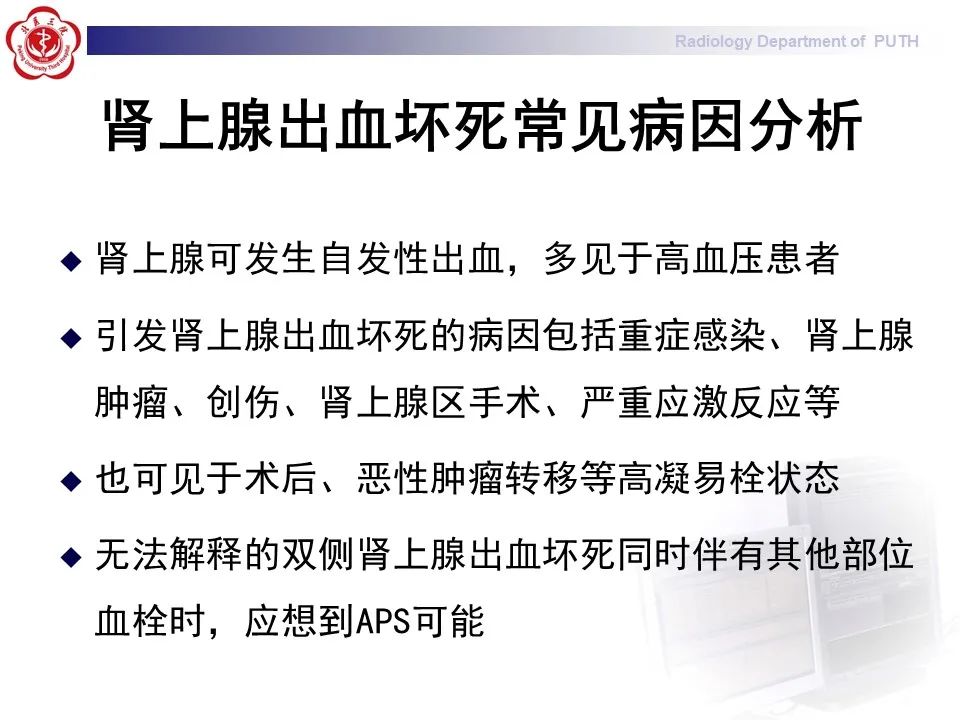 影像PPT - 【PPT】抗磷脂综合征合并双侧肾上腺坏死-28