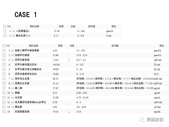 影像PPT - 【病例】卵巢黏液性囊腺瘤 VS 卵巢黄素囊肿-4