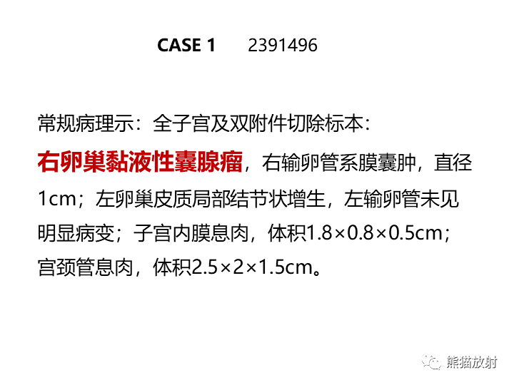 影像PPT - 【病例】卵巢黏液性囊腺瘤 VS 卵巢黄素囊肿-25