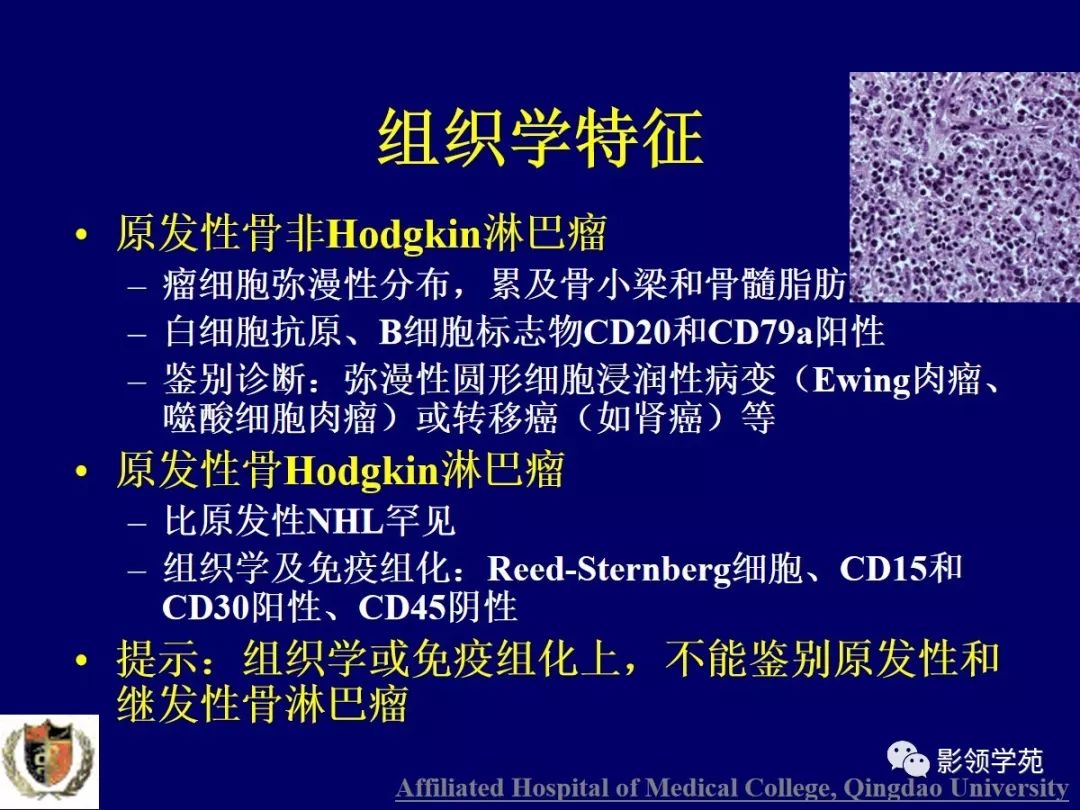 影像PPT - 【PPT】原发性骨淋巴瘤影像学诊断-5