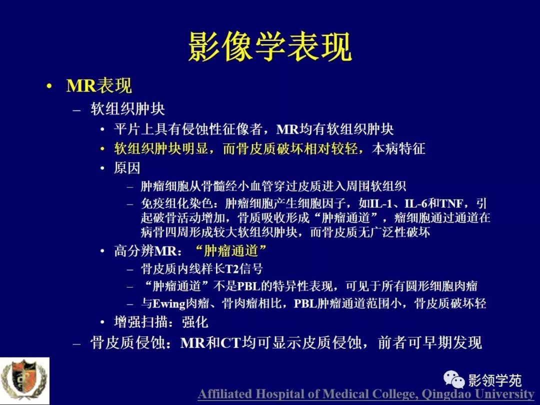 影像PPT - 【PPT】原发性骨淋巴瘤影像学诊断-19