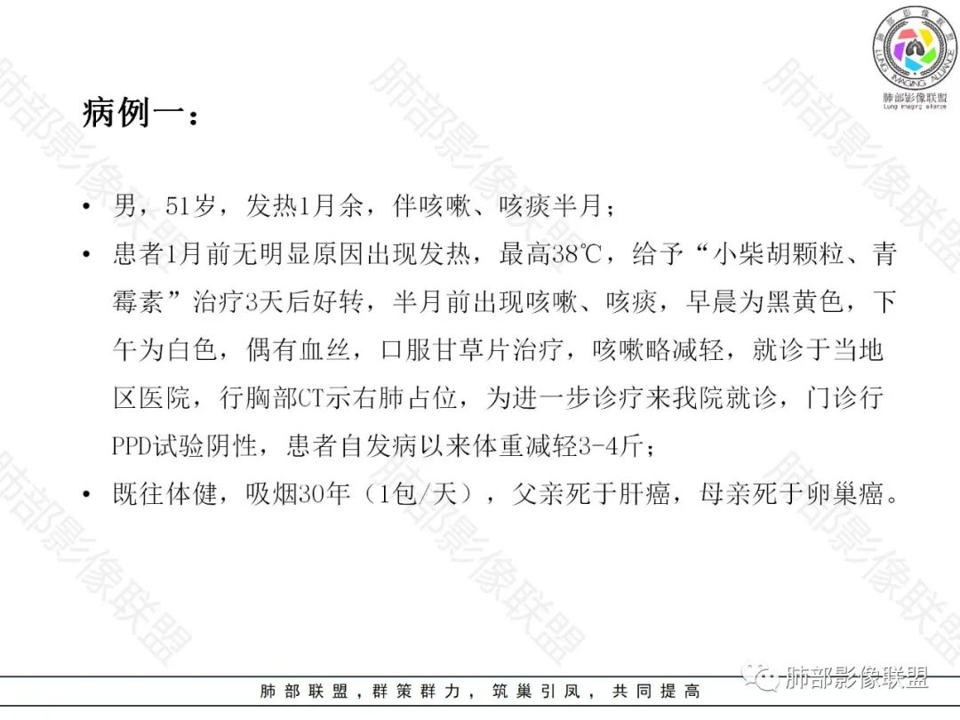 影像PPT - 【病例】局灶性机化性肺炎1例CT影像-2 影像PPT - 【病例】局灶性机化性肺炎1例CT影像-2