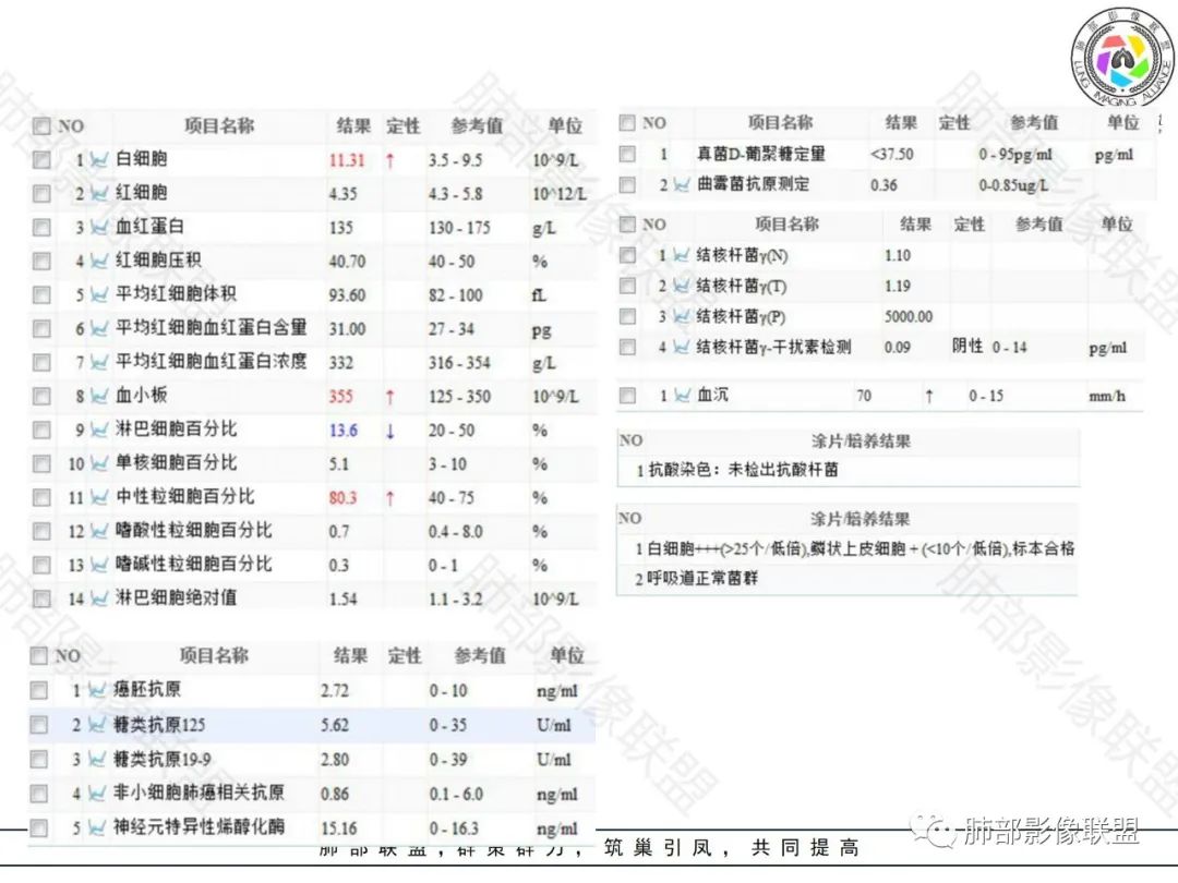 影像PPT - 【病例】局灶性机化性肺炎1例CT影像-3 影像PPT - 【病例】局灶性机化性肺炎1例CT影像-3