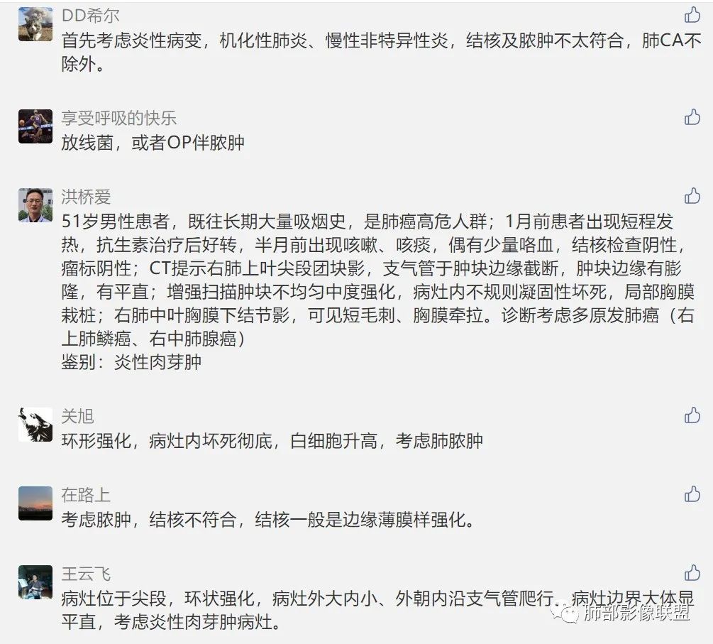 影像PPT - 【病例】局灶性机化性肺炎1例CT影像-22 影像PPT - 【病例】局灶性机化性肺炎1例CT影像-22