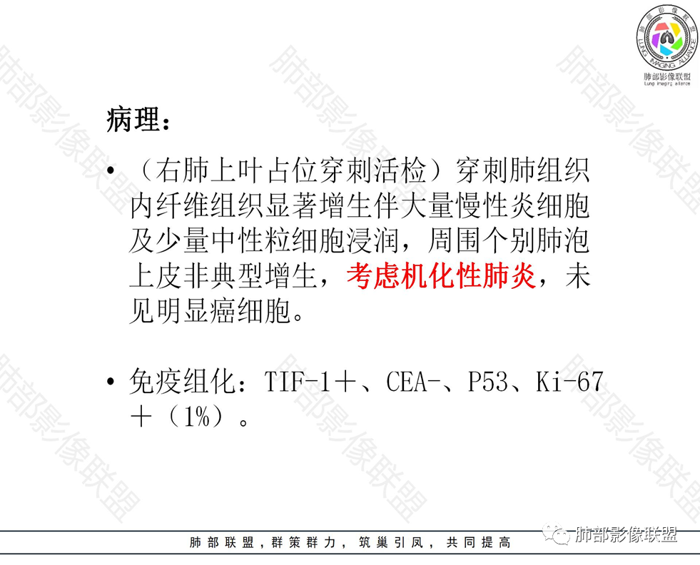 影像PPT - 【病例】局灶性机化性肺炎1例CT影像-28 影像PPT - 【病例】局灶性机化性肺炎1例CT影像-28
