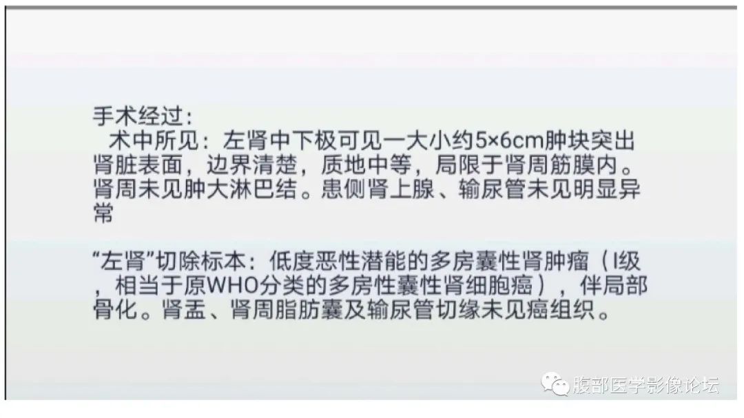 影像PPT - 【病例】肾脏低度恶性潜能多房囊性肾肿瘤1例CT影像-12