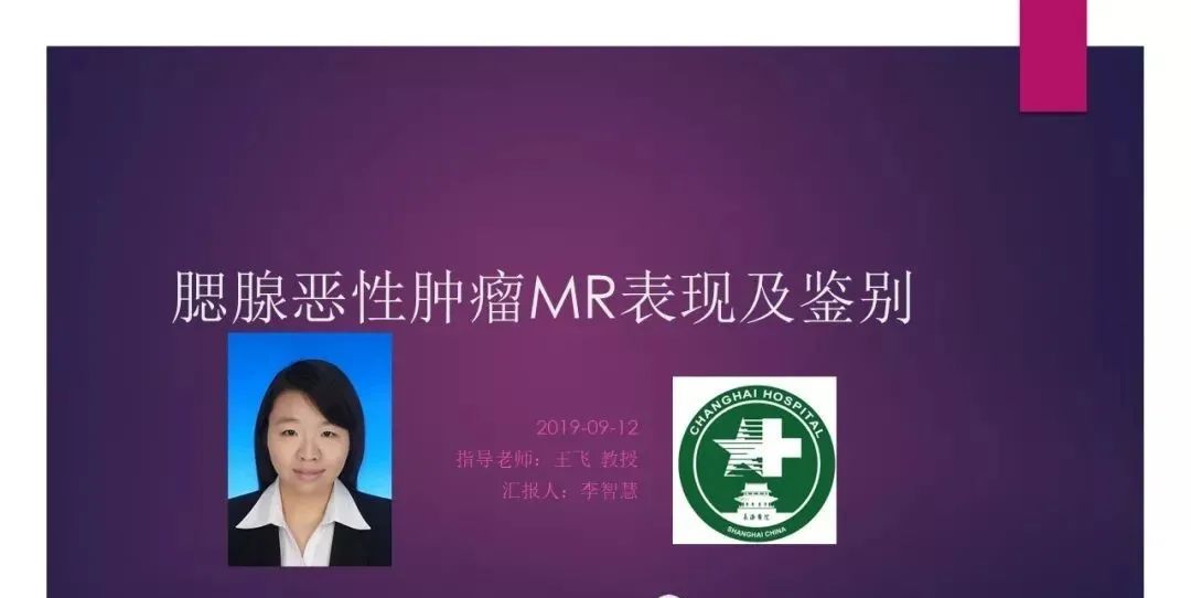 影像PPT - 【PPT】腮腺恶性肿瘤MR表现及鉴别-1