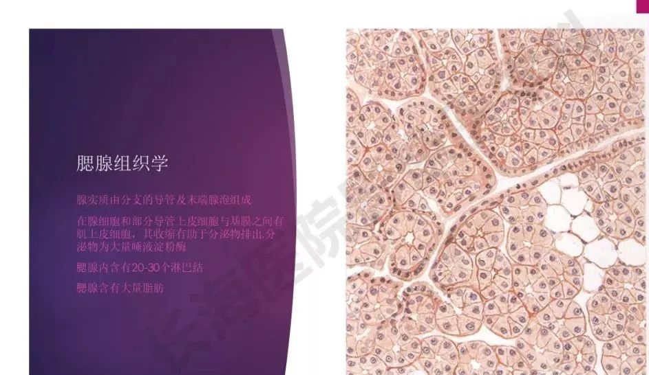 影像PPT - 【PPT】腮腺恶性肿瘤MR表现及鉴别-4