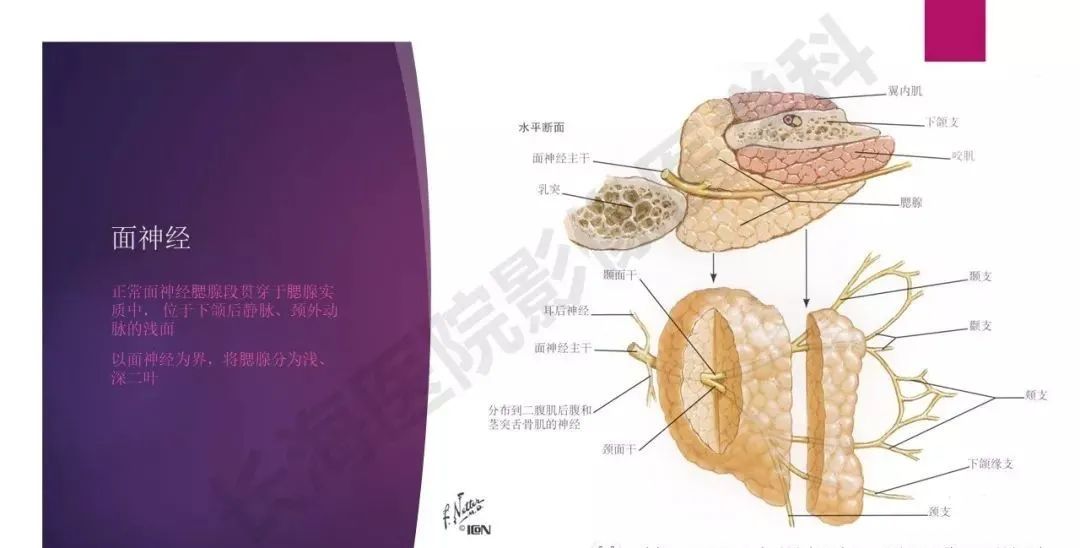 影像PPT - 【PPT】腮腺恶性肿瘤MR表现及鉴别-7