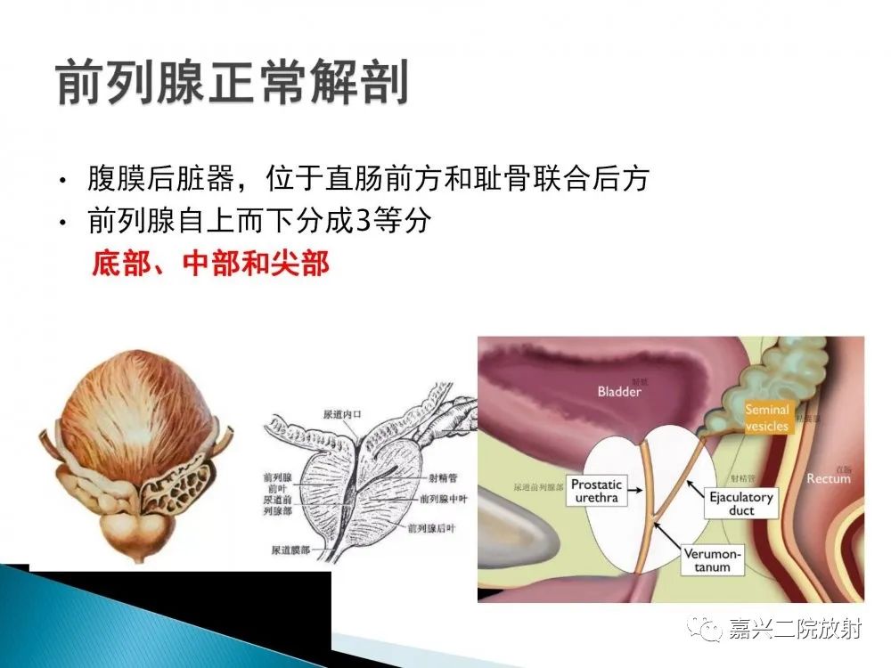 影像PPT - 【PPT】前列腺解剖分区-2
