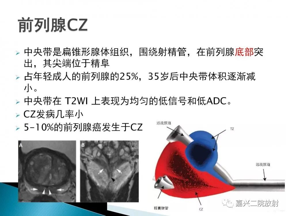 影像PPT - 【PPT】前列腺解剖分区-6