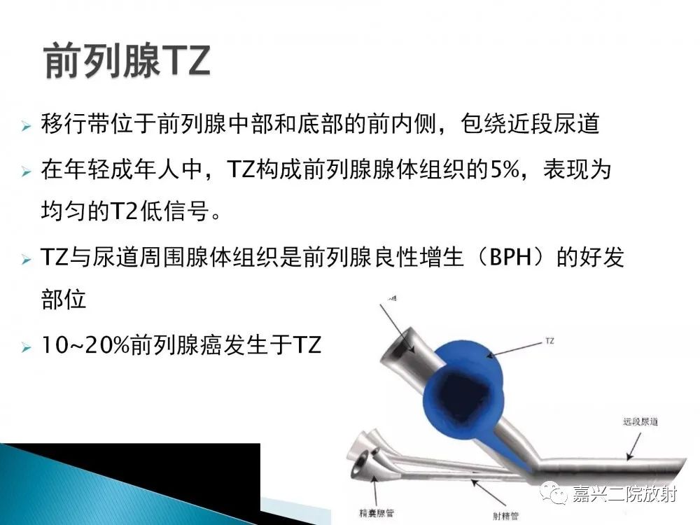 影像PPT - 【PPT】前列腺解剖分区-5