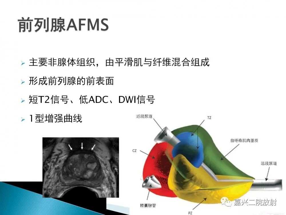 影像PPT - 【PPT】前列腺解剖分区-8