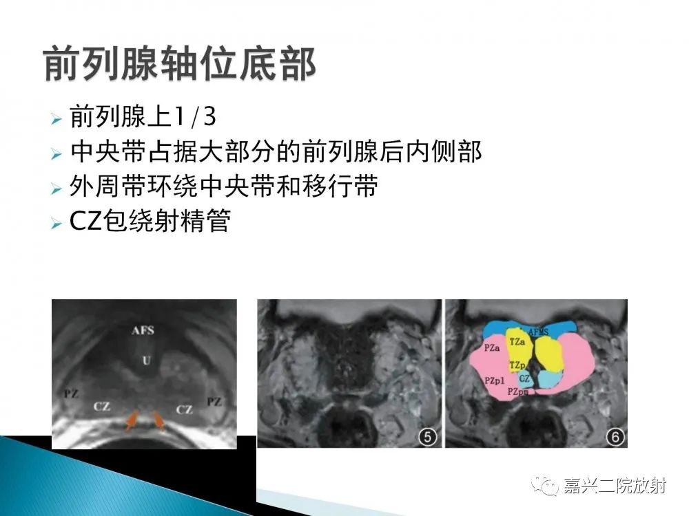 影像PPT - 【PPT】前列腺解剖分区-12