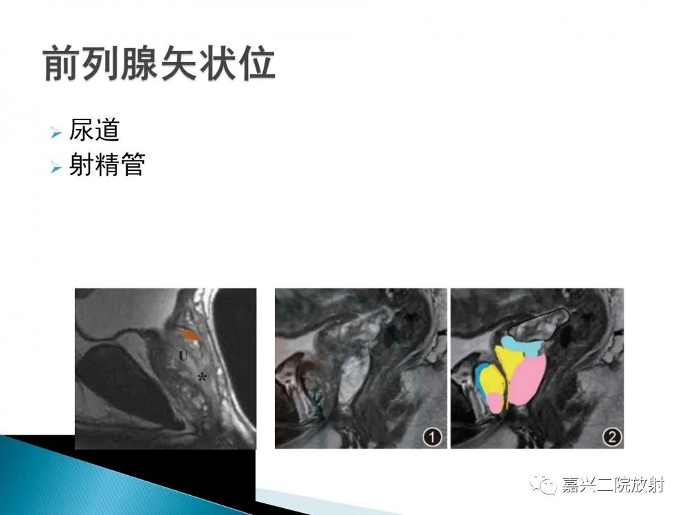 影像PPT - 【PPT】前列腺解剖分区-10