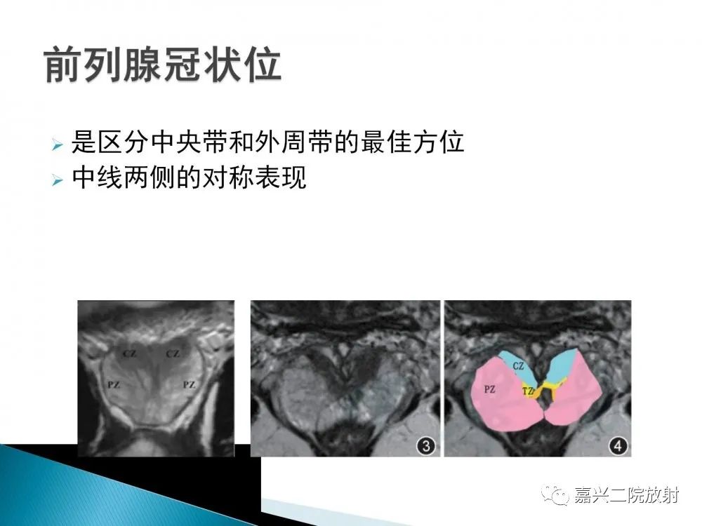 影像PPT - 【PPT】前列腺解剖分区-11