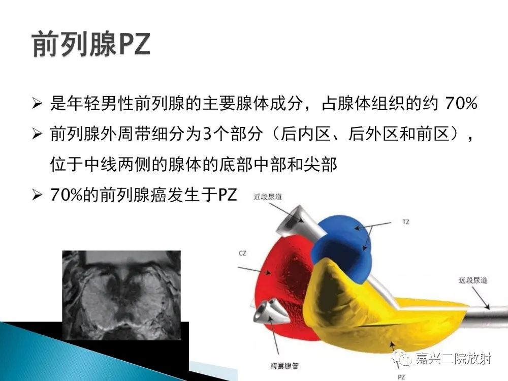 影像PPT - 【PPT】前列腺解剖分区-7