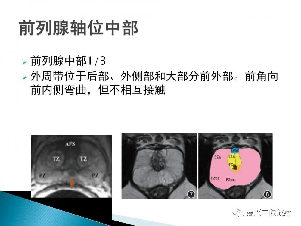 影像PPT - 【PPT】前列腺解剖分区-13