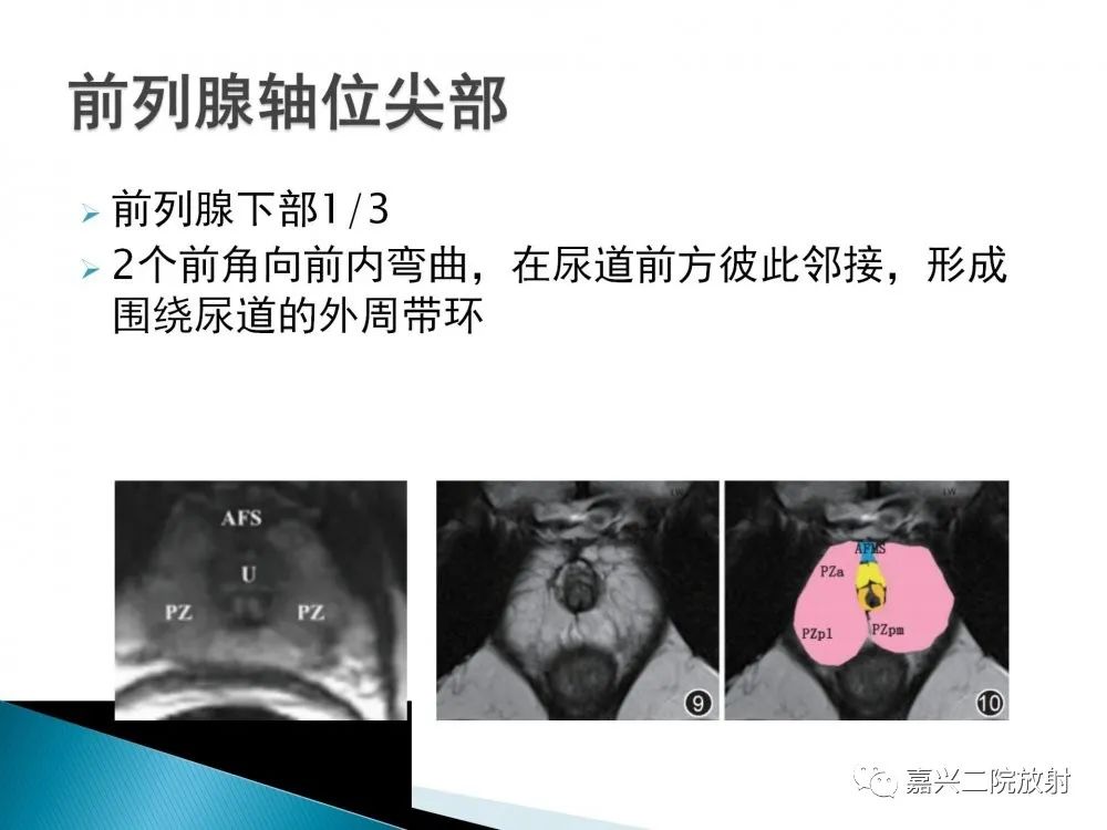 影像PPT - 【PPT】前列腺解剖分区-14